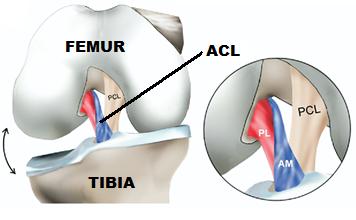 ACL